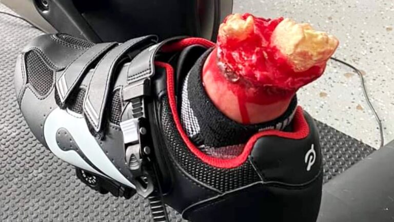 How to Easily Remove Peloton Shoes: Unclipping Made Simple!